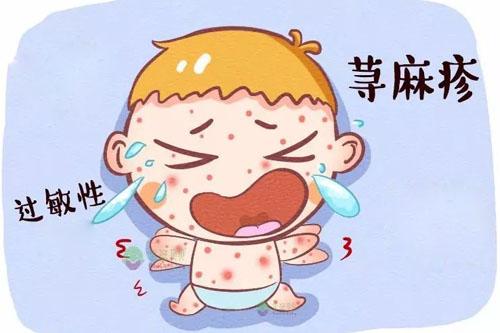 丘疹性荨麻疹饮食要注意什么